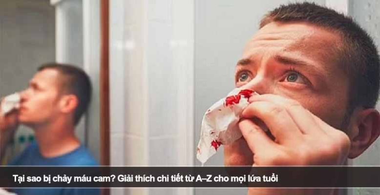 Tại sao bị chảy máu cam? Giải thích chi tiết từ A–Z cho mọi lứa tuổi