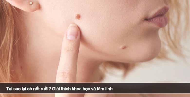 Tại sao lại có nốt ruồi? Giải thích khoa học và tâm linh
