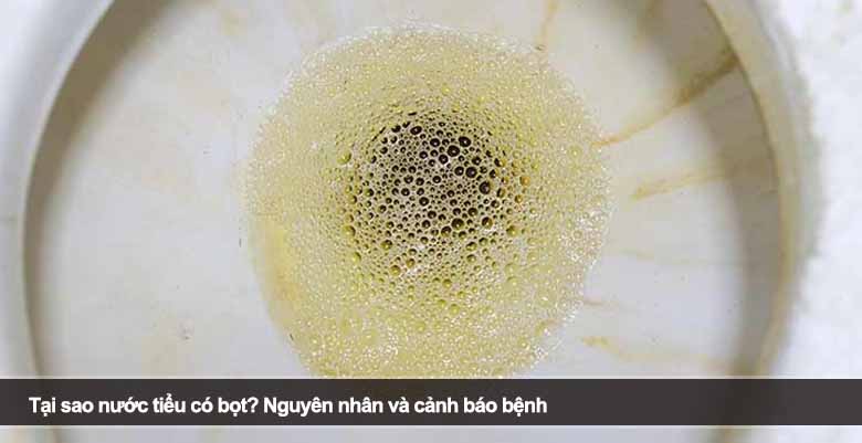 Tại sao nước tiểu có bọt? Nguyên nhân và cảnh báo bệnh 