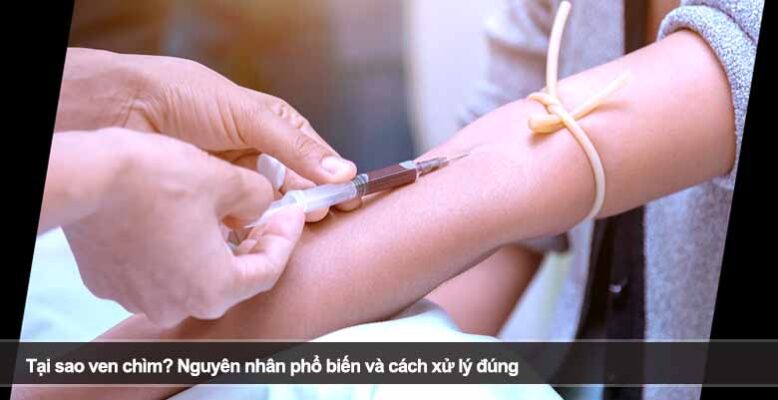 Tại sao ven chìm? Nguyên nhân phổ biến và cách xử lý đúng