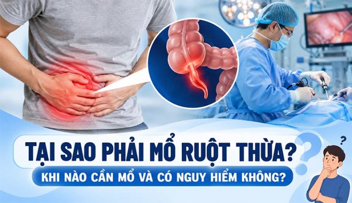 Tại sao phải mổ ruột thừa? Khi nào cần mổ và có nguy hiểm không?